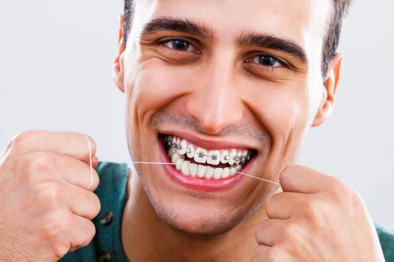 como-usar-fio-dental-com-aparelho-ortodontico-810×540